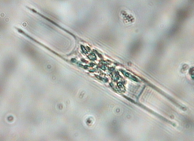 Dictyocha speculum